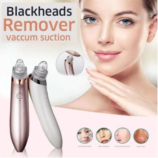 Face Vacuum Blackhead Remover Pore Cleaner – Deep Cleanse for Clear