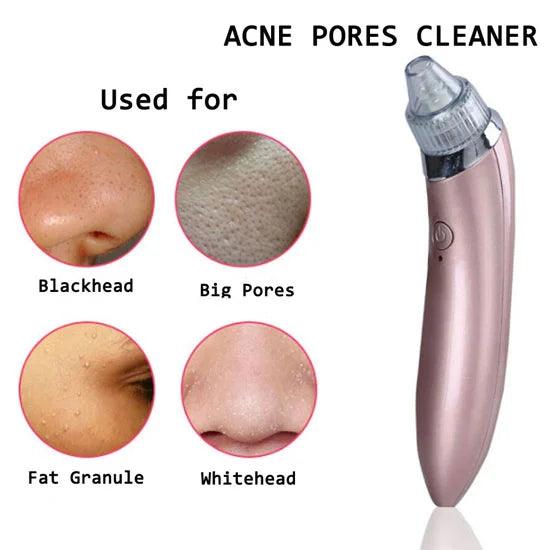 Face Vacuum Blackhead Remover Pore Cleaner – Deep Cleanse for Clear